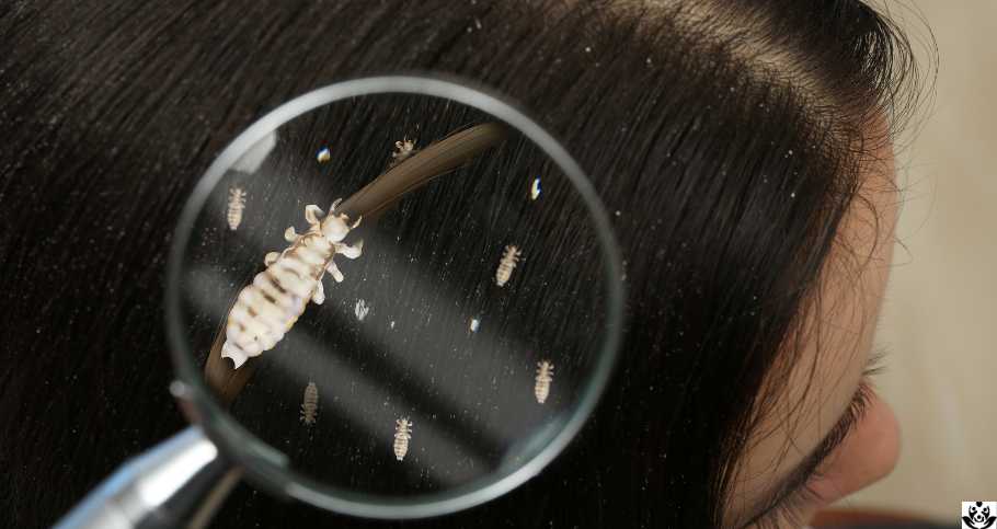What Does It Mean When You Dream About Lice