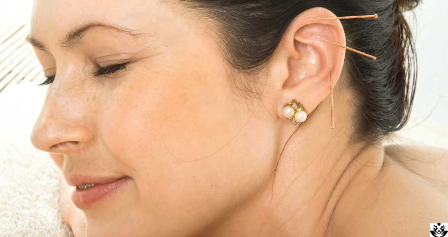 Auriculoterapia para Bajar de Peso: ¿Qué Es y Cómo Funciona con Balines?