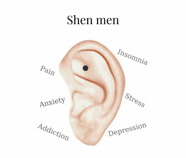 🥇 Balines Para Adelgazar【 2021 】Auriculoterapia para bajar de peso