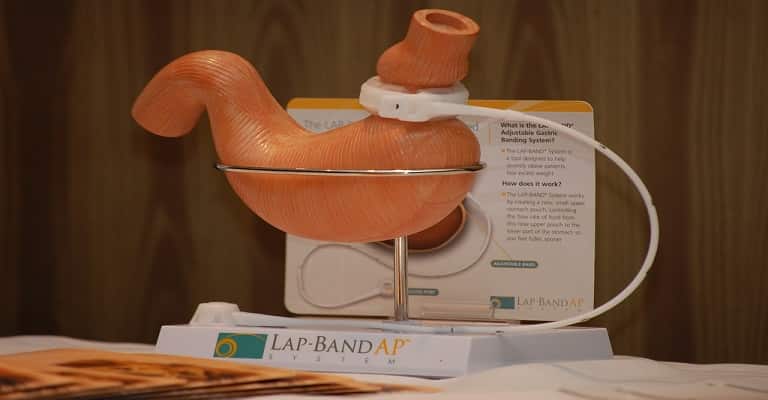 How Much Weight Can You Lose With Lap Band Surgery
