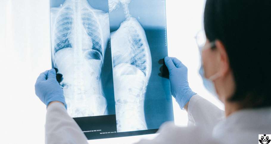 precio de una radiografia en estados unidos